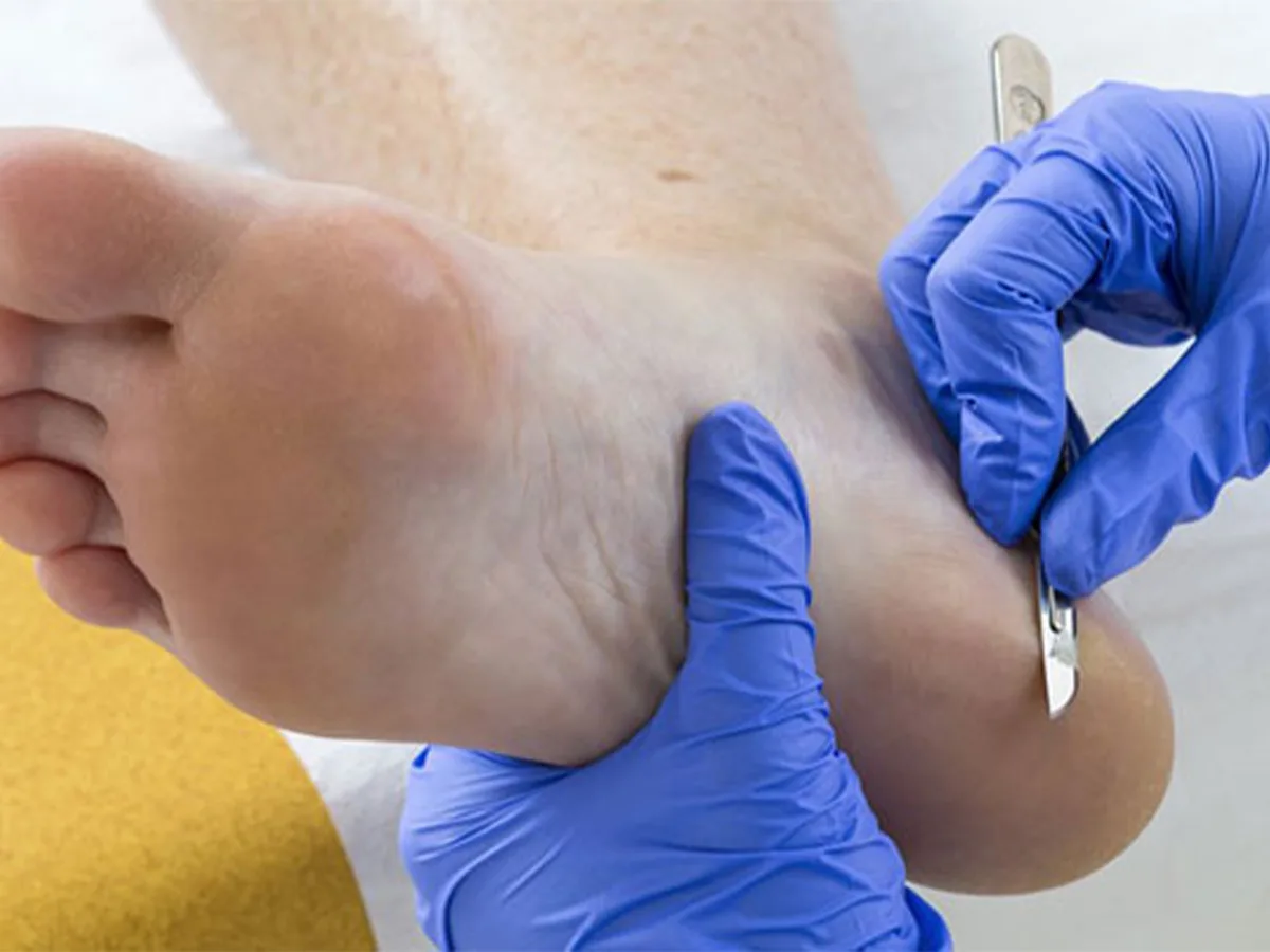 Cuidado integral para la salud y belleza de tus pies